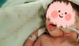 【用爱与专业守护生命】我院成功救治一名重度窒息早产儿