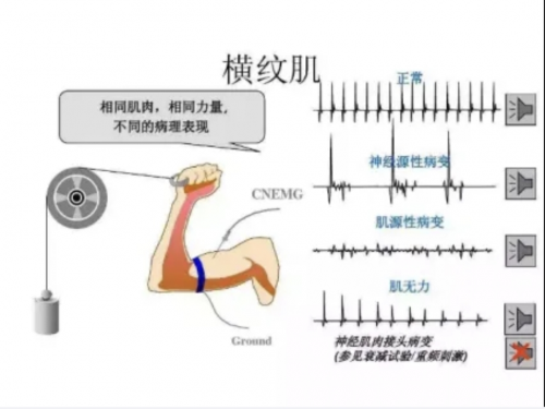 【红医科普】神经电生理检查，你了解吗？