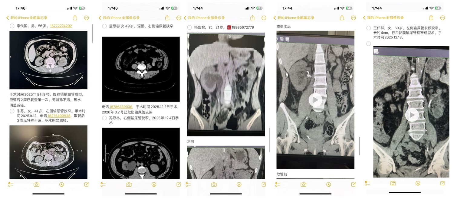 输尿管狭窄影像评估